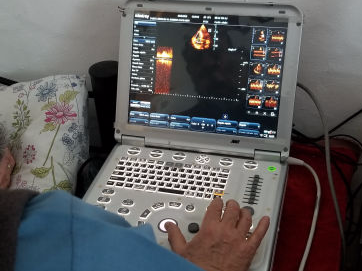 ecocardiograma doppler color para apto medico